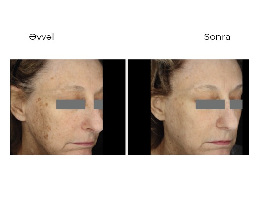 Candela Nordlys Mini